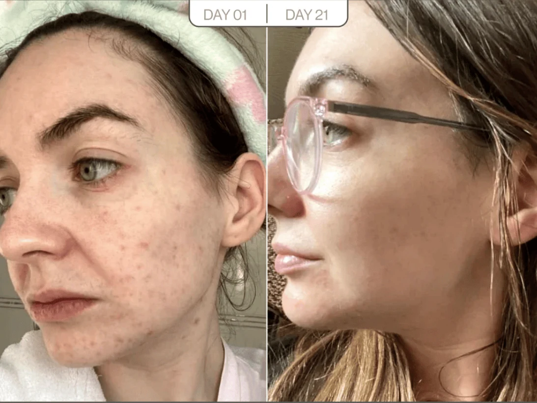 Skin radiance before and after result